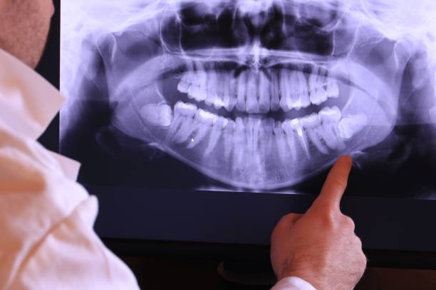 Best Emergency Tooth Extraction in Palo Cedro, CA