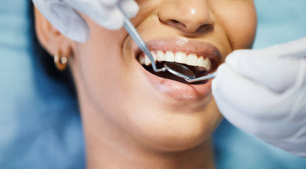 Best Emergency Broken Tooth Repair in Palo Cedro, CA